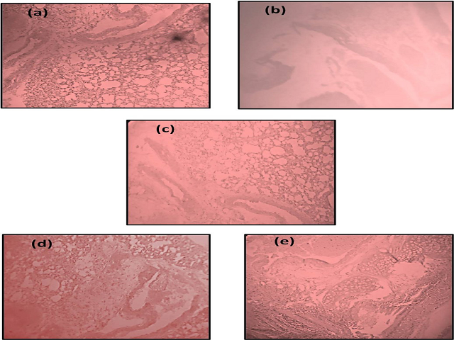 Figure 7: Evidence for the protective effect of Amaranthus cruentus extract in rats treated with isoprenaline; (a) normal control, (b) Isoprenaline, (c) Atrovastatin (d) Hesperidin 25 mg/kg p.o (e) Amaranthus cruentus 200 mg/kg p.o., (f ) Amaranthus cruentus 400 mg/kg p.o.,
