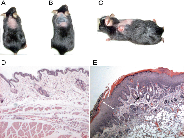 DMBA/TPA treatment induces papillomas and pigmentation patches in NF1 and control mice