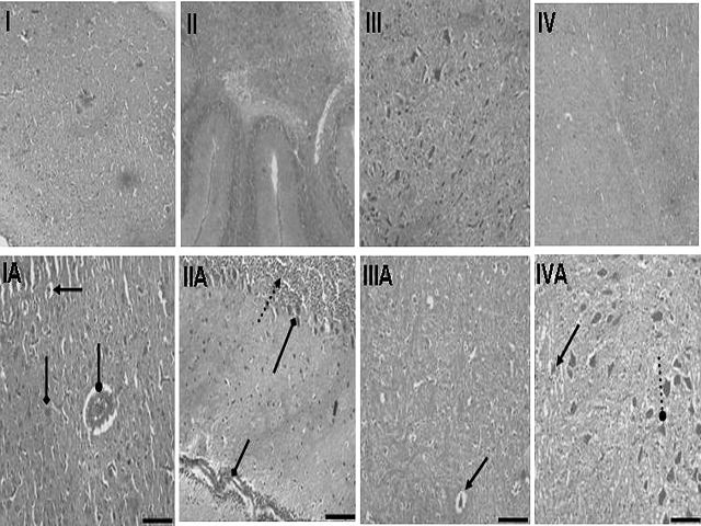 Photographs showing histopathological changes in different brain regions of chicken during NDV infection; control, cerebrum (I), cerebellum (II), optic lobes (III) and brain stem (IV); infected groups (IA), (IIA), (IIIA) and (IVA) e showed several abnormalities (indicated by arrows); glial cells; hemorrhage; encephalomalacia; lymph mononuclear infiltrate; vacuolated cytoplasm. H&E stain: Lens (40 IAeIVA & 10 IeIV). Bars ¼ 10 mm.