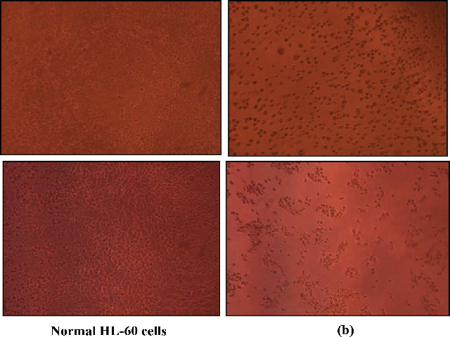 Fisetin induced morphological changes in U-937 (a) and HL-60 cells (b) at 1000 μM/mL concentration (magnification 100X).