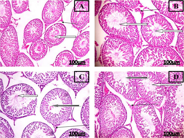 Representative testes histopathological sections of plumbagininduced testicular impairment in rats treated with AFOG.